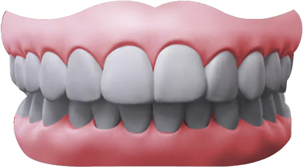 Overbite2